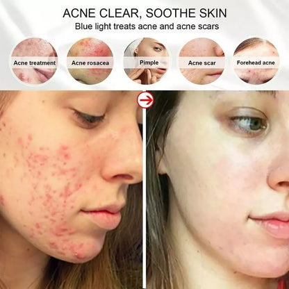 MASQUE FACIAL LED™ - Révélez Votre Éclat Naturel avec une Technologie Avancée!